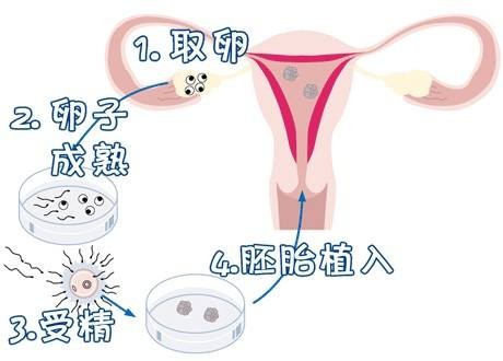 胚胎培养